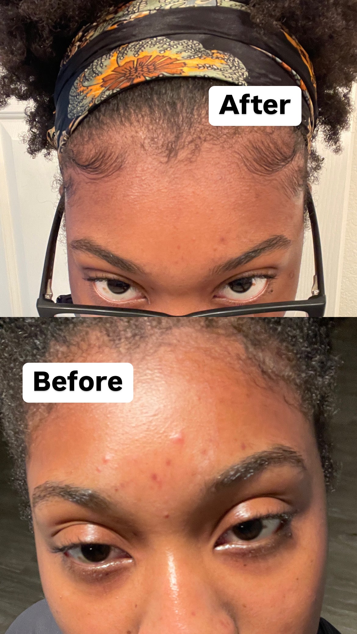 Tumeric Face & Bodybar